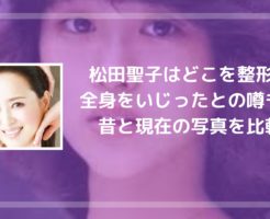 松田聖子はどこを整形？全身をいじったとの噂も！昔と現在の写真を比較